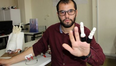  Mühendislik öğrencisi kendine protez parmak yaptı