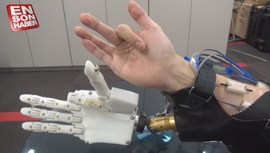 Düşünce ile kontrol edilebilen robotik kol