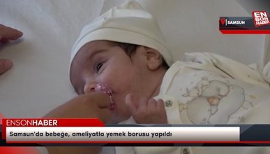 Samsun'da bebeğe, ameliyatla yemek borusu yapıldı