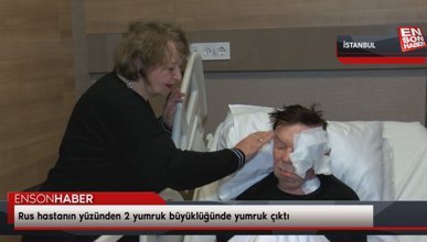 İstanbul'a gelen Rus hastanın yüzünden 2 yumruk büyüklüğünde yumruk çıktı