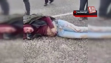 Gaziantep'te kaza yaptı, ‘yüzümde şişlik var mı’ diye sordu