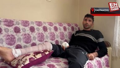 Kastamonu'da komşusunun köpeğinin saldırısına uğradı: Parmağı koptu