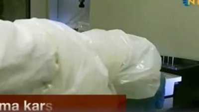 Yaşlanma karşıtı çikolata