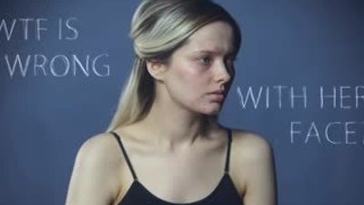 Akne sorunu yaşayan genç kızın meydan okuması