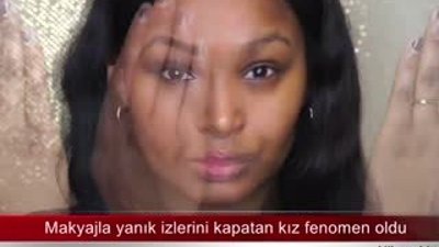 Makyajla yanık izlerini kapatan kız fenomen oldu