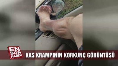 Kas krampının korkunç görüntüsü