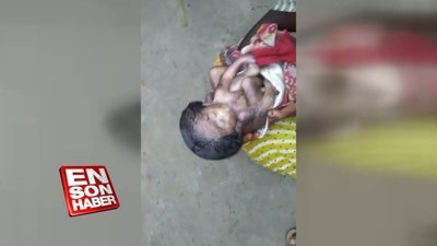 Arkalı önlü ikiz kardeşler