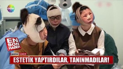 Estetik yaptırdılar, tanınmadılar