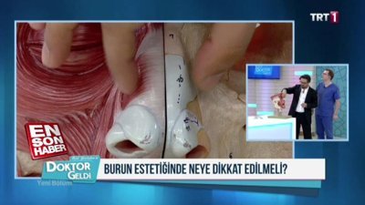 Açık teknikle burun ameliyatı nasıl yapılır?