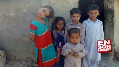 9 yaşındaki kız, hastalığı nedeniyle boynunu yatırarak yaşıyor