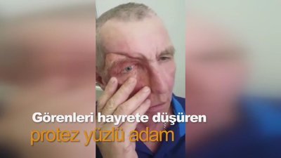 Görenleri hayrete düşüren protez yüzlü adam