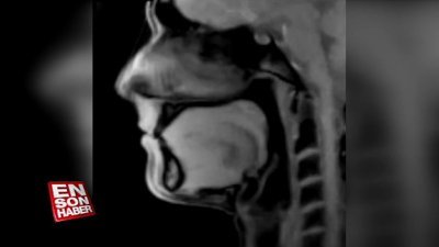 Bir insanın konuşurken dilin hareketleri kaydedildi