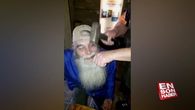 Çekiç ve pense ile diş çekimi