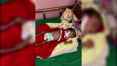 Yemen'de insani kriz ölümcül noktada