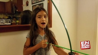 Ok ile dişini çeken ufaklık kamerada