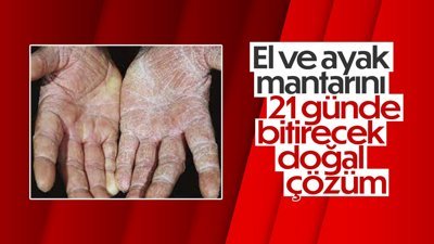 El ve ayak mantarından, 2 basit malzemeyle kurtulun! Ahmet Maranki tarif verdi