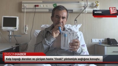 Kalp kapağı daralan ve çürüyen hasta 