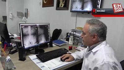 Bölgenin arazi şartları ve bol yağışlı olması o hastalığa zemin hazırlıyor