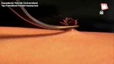 Bakan Koca'dan kene uyarısı: Temmuz sonuna kadar dikkatli olunmalı