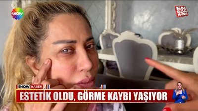 Estetik ameliyat olan kadının göz rengi değişti