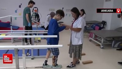 Ankara’da 51 depremzedeye protez sağlandı