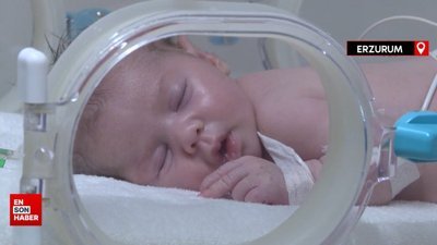 Erzurum'da prematüre doğan bebeklerin, kuvözden anne kucağına yolculuğu