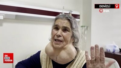 Denizli'de doktordan korktuğu için yıllarca devasa kitleyle yaşadı