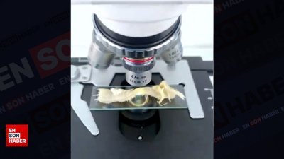 Kuzu işkembesi mikroskop altında incelendi