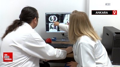 Akciğer kanserinde yapay zeka destekli tedavi