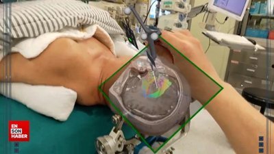 Beyin cerrahisi için  geliştirilen artırılmış gerçeklik teknolojisi