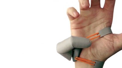 Sağ elin işlevini iyileştiren 6. parmak geliştirildi