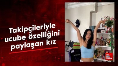 Takipçileriyle ucube özelliğini paylaşan kız
