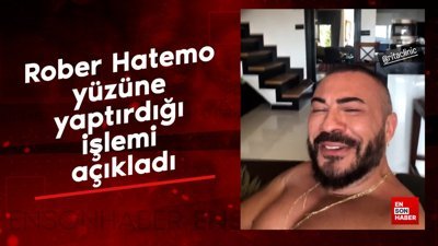 Şarkıcı Rober Hatemo yüzüne yaptırdığı işlemi açıkladı