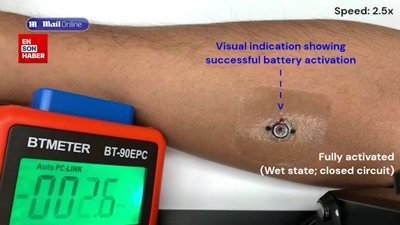 Yaraları elektrikle iyileştiren akıllı bandaj