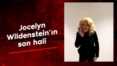 Kedi Kadın Jocelyn Wildenstein'ın son hali görenleri şaşırttı