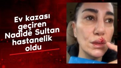 Ev kazası geçiren Nadide Sultan hastanelik oldu