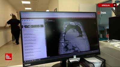 Giresun'dan dünya tıbbına yeni tanı: Karadeniz sendromu