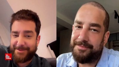 Oyuncu Enis Arıkan'ın saçsız hali