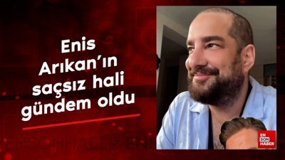 Protez saçını çıkardı: Enis Arıkan'ın saçsız hali gündem oldu