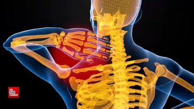 Skolyoz tedavisinde en önemli adım: Erken tanı