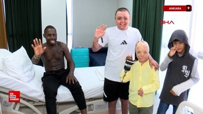 Yüzü yanan Ugandalı çoban Ankara'da tedavi edildi
