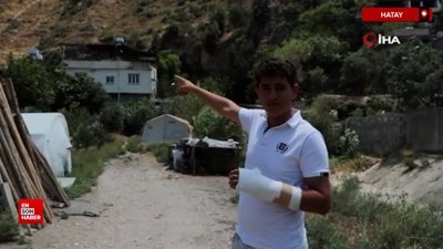 Hatay'da alevler evine sıçramasın diye mücadele verdi: Eli kırıldı