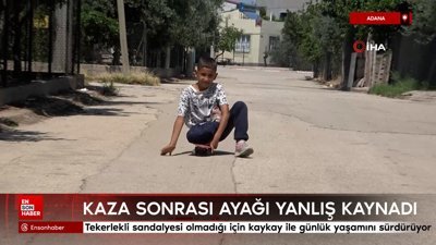 Adana'da kaza sonrası ayağı yanlış kaynadı