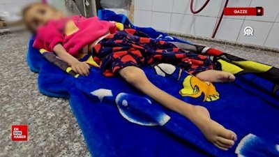 Gazze'de yetersiz beslenme nedeniyle Sena bebek yaşamını yitirdi
