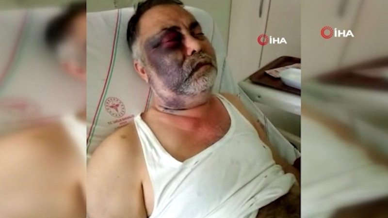 Antalya'da yüzde 90 engelli adamı öldüresiye darbettiler