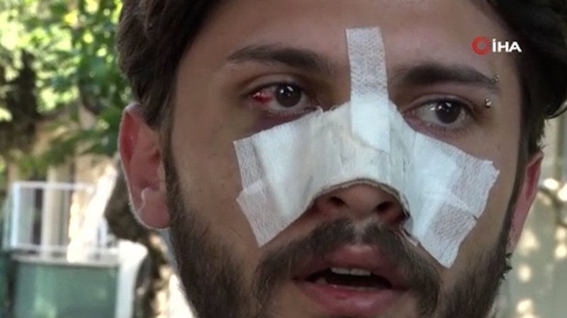 Antalya’da kiracı gence ucuz kira dayağı iddiası