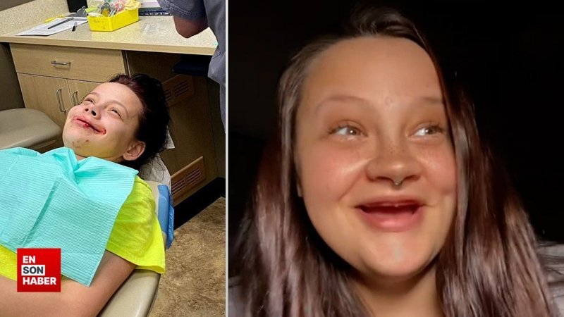 Gülüşünü düzeltmek için 21 dişini çektiren Amerikalı