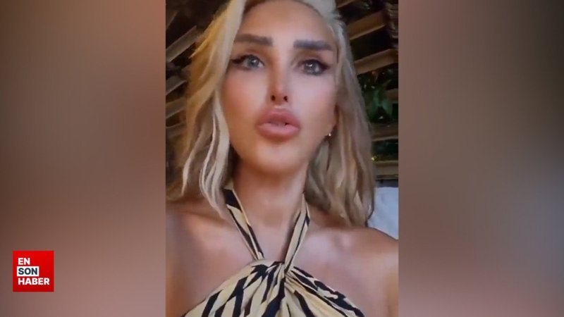 Seren Serengil'den sokak köpeği savunması: Korkan insan tedavi olsun