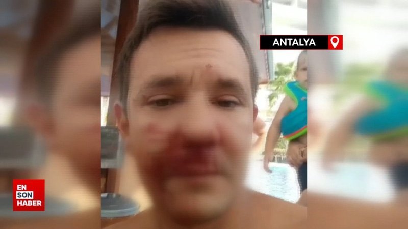 Antalya'da site yöneticisi Rus vatandaşı darbetti