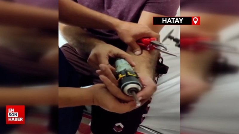 Hatay'da matkaba sıkışan parmağını itfaiye çıkarttı